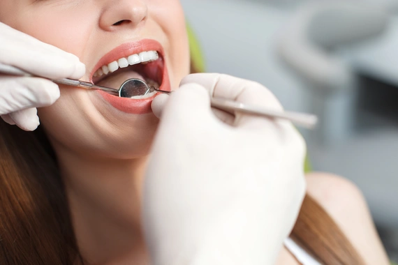 Dental cleaning