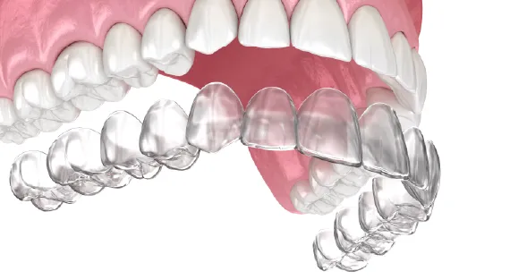 Clear aligners
